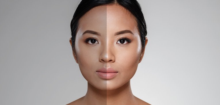 Intense-depigmentation - Cosmelan Skin Brightening Treatment, DAC Kochi
