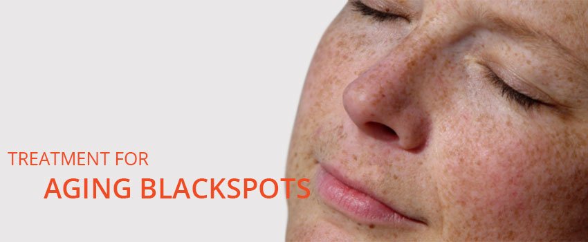Aging Black Spots Treatment Skin Clinic Kochi